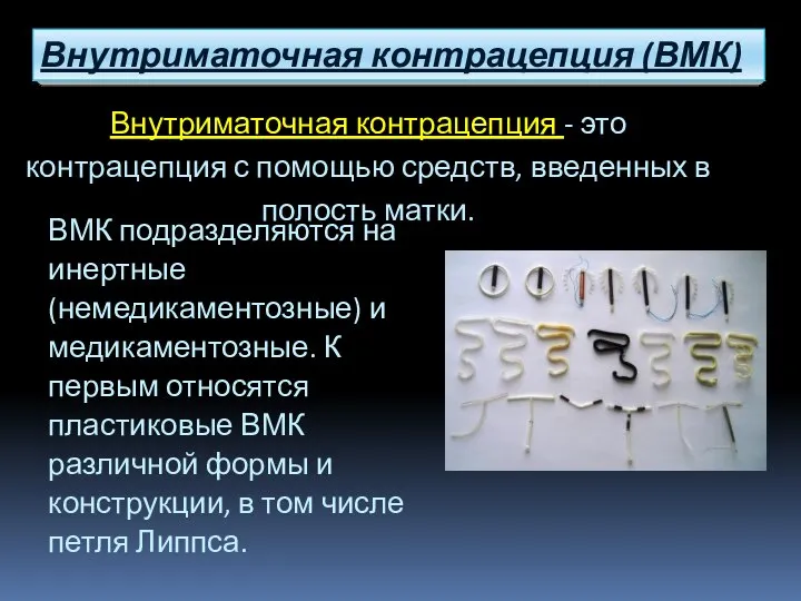 Внутриматочная контрацепция - это контрацепция с помощью средств, введенных в полость