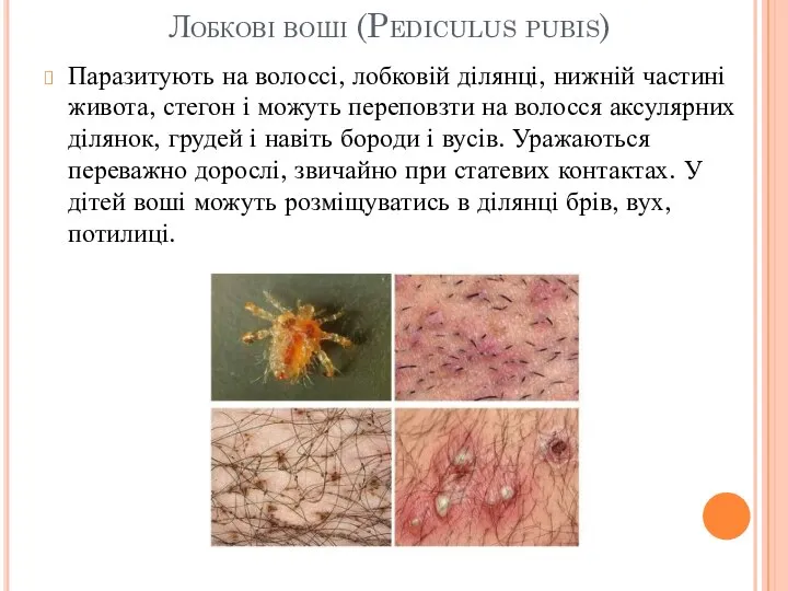 Лобкові воші (Pediculus pubis) Паразитують на волоссі, лобковій ділянці, нижній частині