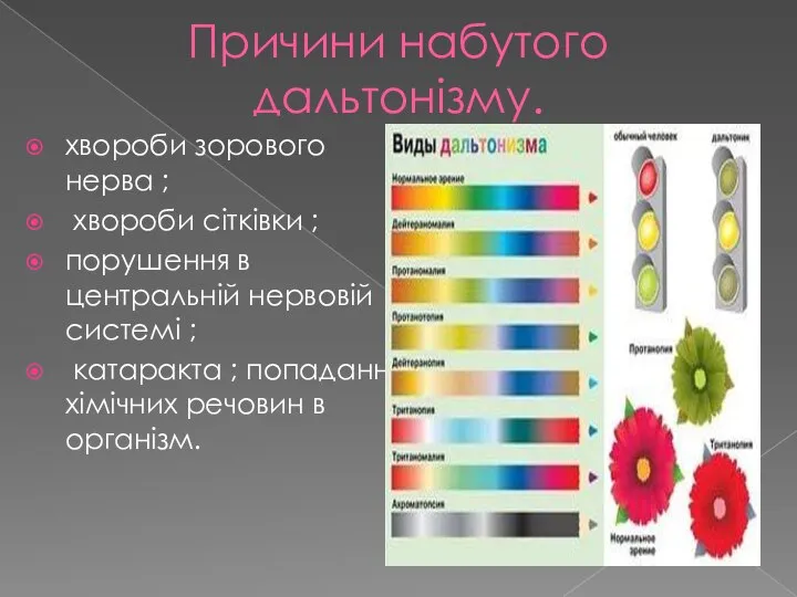 Причини набутого дальтонізму. хвороби зорового нерва ; хвороби сітківки ; порушення