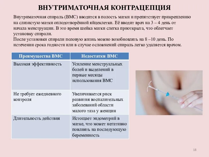 ВНУТРИМАТОЧНАЯ КОНТРАЦЕПЦИЯ Внутриматочная спираль (ВМС) вводится в полость матки и препятствует