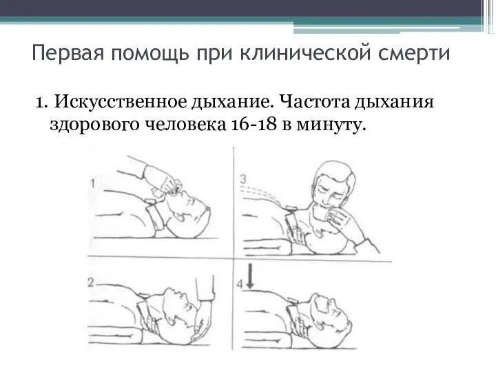 Первая помощь при клинической смерти 1. Искусственное дыхание. Частота дыхания здорового человека 16-18 в минуту.