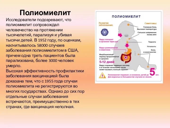 Полиомиелит Исследователи подозревают, что полиомиелит сопровождал человечество на протяжении тысячелетий, парализуя