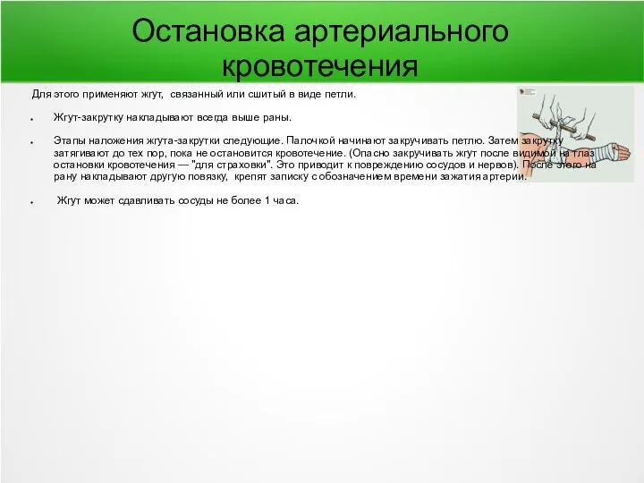 Остановка артериального кровотечения Для этого применяют жгут, связанный или сшитый в