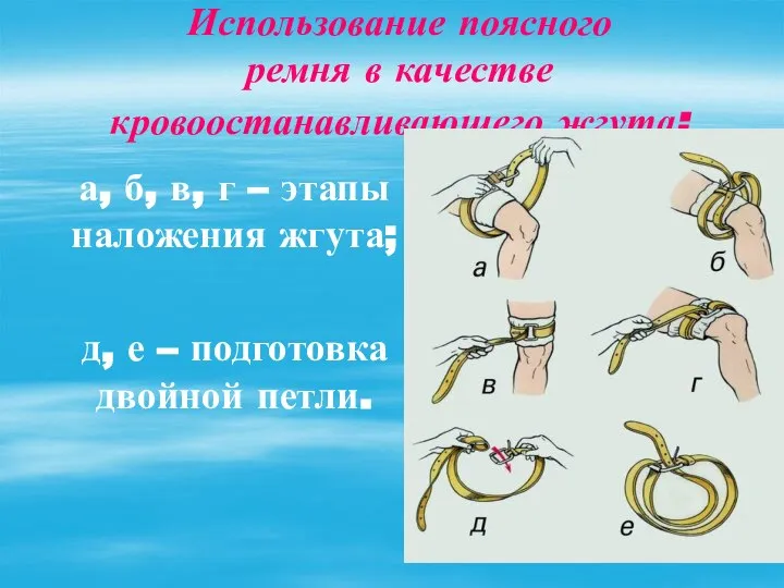 Использование поясного ремня в качестве кровоостанавливающего жгута: а, б, в, г