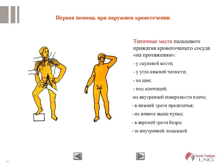 Первая помощь при наружном кровотечении Типичные места пальцевого прижатия кровоточащего сосуда