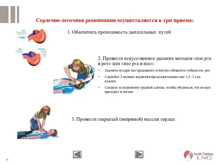 Сердечно-легочная реанимация осуществляется в три приема: 1. Обеспечить проходимость дыхательных путей