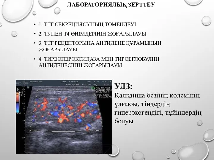 ЛАБОРАТОРИЯЛЫҚ ЗЕРТТЕУ 1. ТТГ СЕКРЕЦИЯСЫНЫҢ ТӨМЕНДЕУІ 2. Т3 ПЕН Т4 ӨНІМДЕРІНІҢ