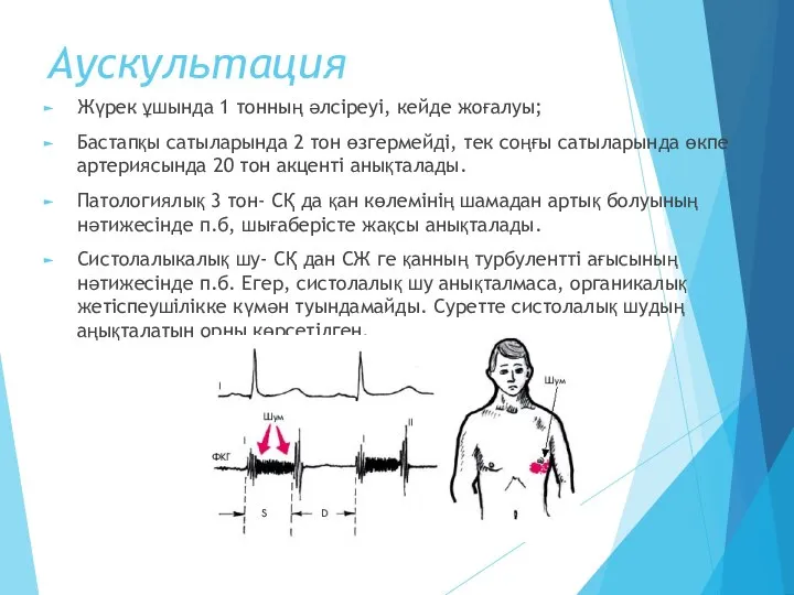 Аускультация Жүрек ұшында 1 тонның әлсіреуі, кейде жоғалуы; Бастапқы сатыларында 2