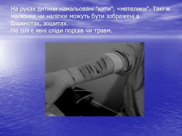 На руках дитини намальовані "кити", «метелики". Такі ж малюнки чи наліпки