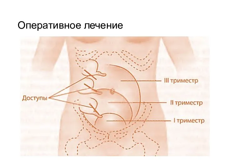 Оперативное лечение