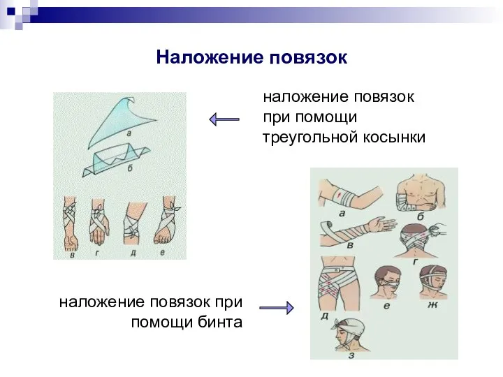 Наложение повязок наложение повязок при помощи треугольной косынки наложение повязок при помощи бинта