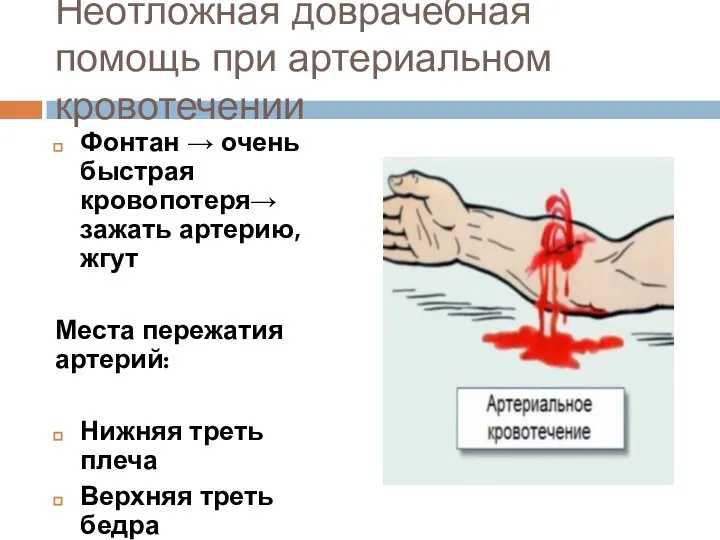 Неотложная доврачебная помощь при артериальном кровотечении Фонтан → очень быстрая кровопотеря→