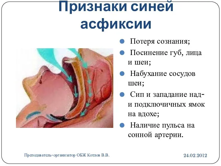 Признаки синей асфиксии 24.02.2012 Преподаватель-организатор ОБЖ Котлов В.В. Потеря сознания; Посинение