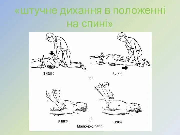 «штучне дихання в положенні на спині»