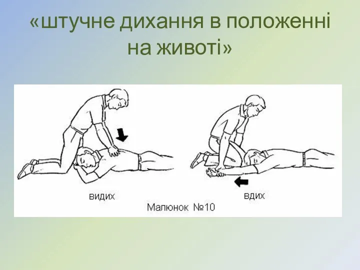 «штучне дихання в положенні на животі»