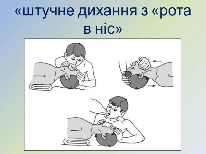 «штучне дихання з «рота в ніс»