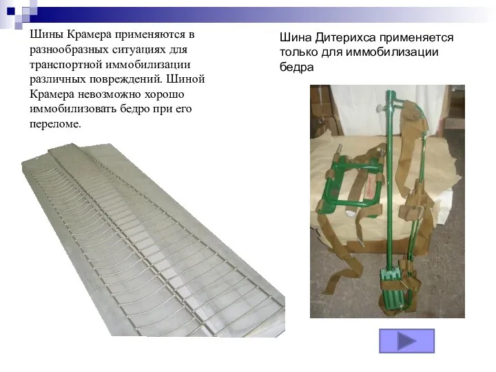 Шины Крамера применяются в разнообразных ситуациях для транспортной иммобилизации различных повреждений.