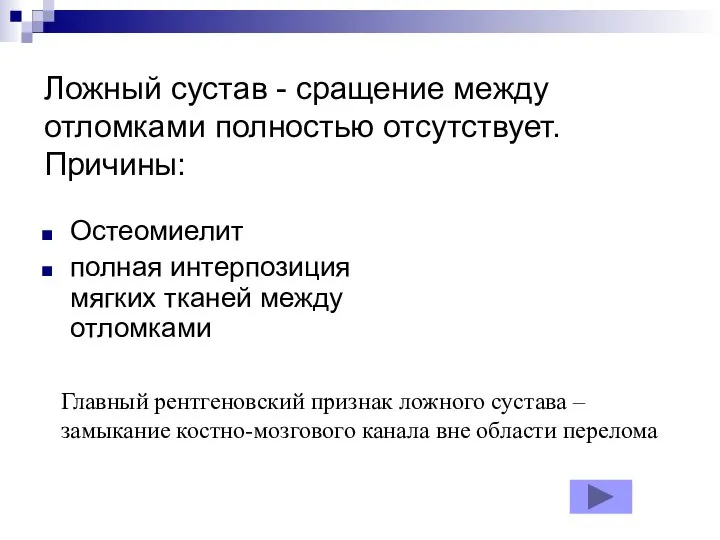 Ложный сустав - сращение между отломками полностью отсутствует. Причины: Остеомиелит полная