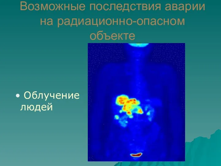 Возможные последствия аварии на радиационно-опасном объекте Облучение людей