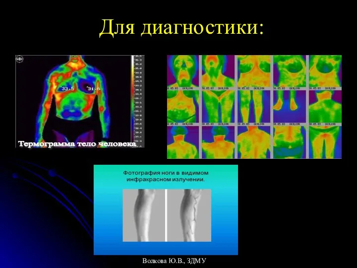 Для диагностики: Волкова Ю.В., ЗДМУ