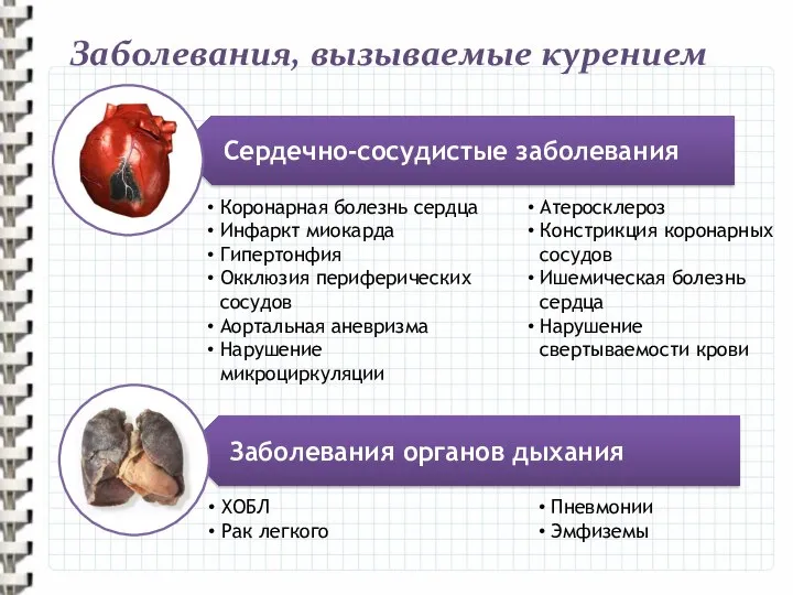 Сердечно-сосудистые заболевания Заболевания органов дыхания Заболевания, вызываемые курением Коронарная болезнь сердца