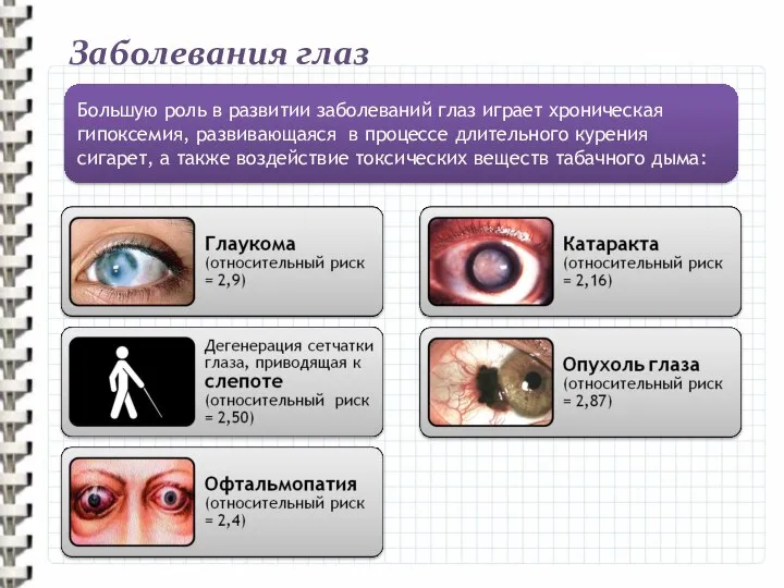 Заболевания глаз Большую роль в развитии заболеваний глаз играет хроническая гипоксемия,