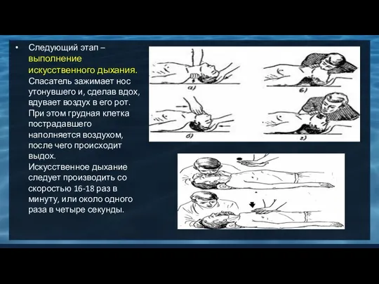 Следующий этап – выполнение искусственного дыхания. Спасатель зажимает нос утонувшего и,