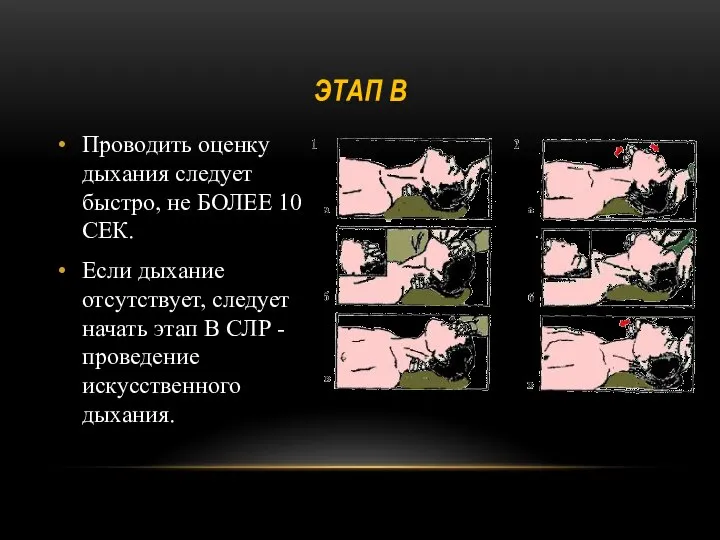 ЭТАП В Проводить оценку дыхания следует быстро, не БОЛЕЕ 10 СЕК.