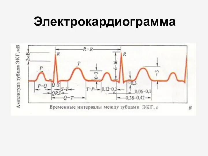 Электрокардиограмма