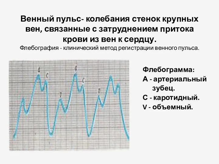 Венный пульс- колебания стенок крупных вен, связанные с затруднением притока крови