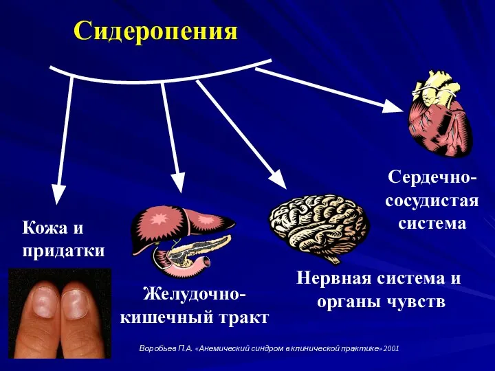 Сидеропения Кожа и придатки Желудочно- кишечный тракт Нервная система и органы