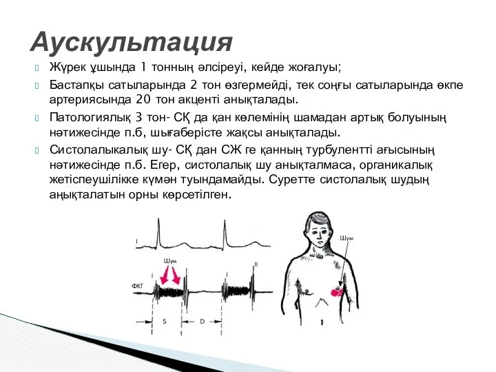 Жүрек ұшында 1 тонның әлсіреуі, кейде жоғалуы; Бастапқы сатыларында 2 тон