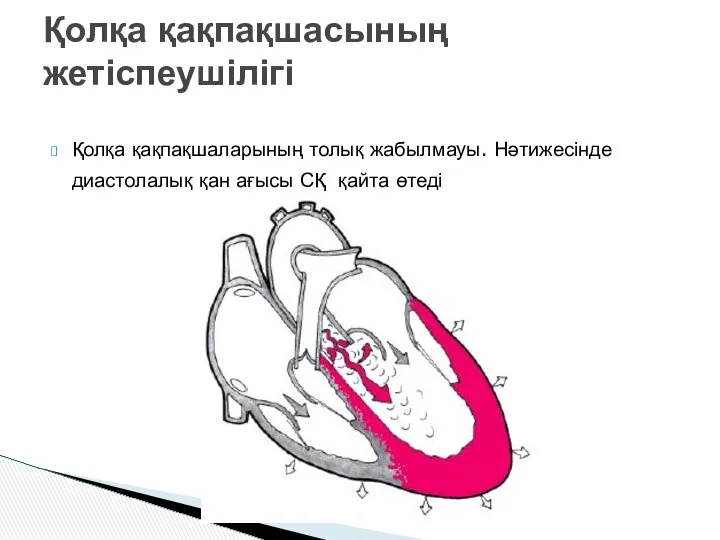 Қолқа қақпақшаларының толық жабылмауы. Нәтижесінде диастолалық қан ағысы СҚ қайта өтеді Қолқа қақпақшасының жетіспеушілігі