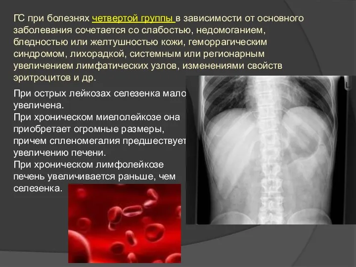 ГС при болезнях четвертой группы в зависимости от основного заболевания сочетается