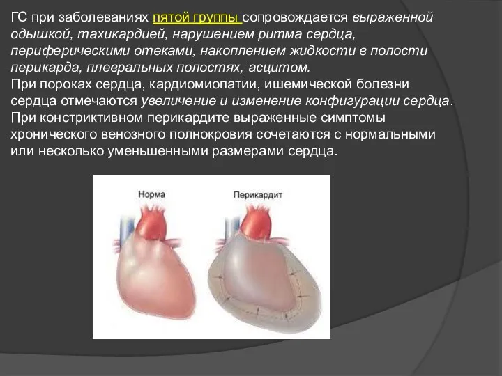 ГС при заболеваниях пятой группы сопровождается выраженной одышкой, тахикардией, нарушением ритма