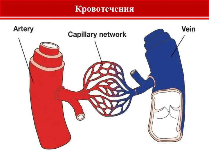 Кровотечения