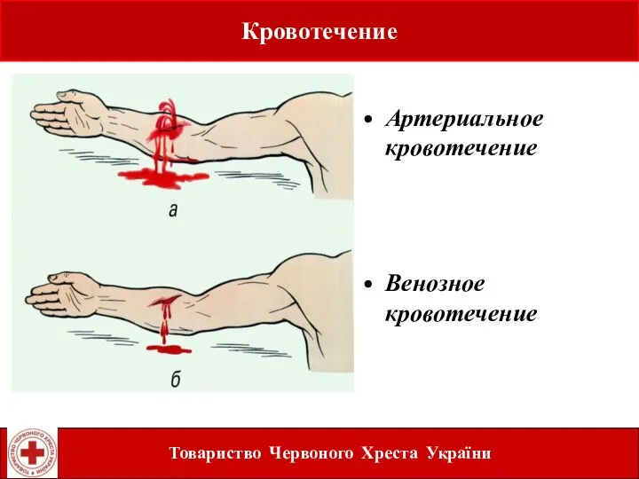 Learning objectives Артериальное кровотечение Венозное кровотечение Кровотечение Товариство Червоного Хреста України