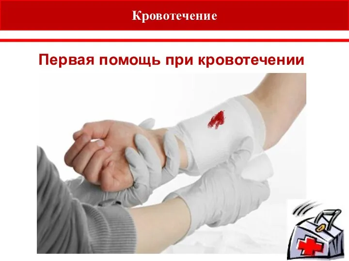 e. how to treat a big bleed Кровотечение Первая помощь при кровотечении