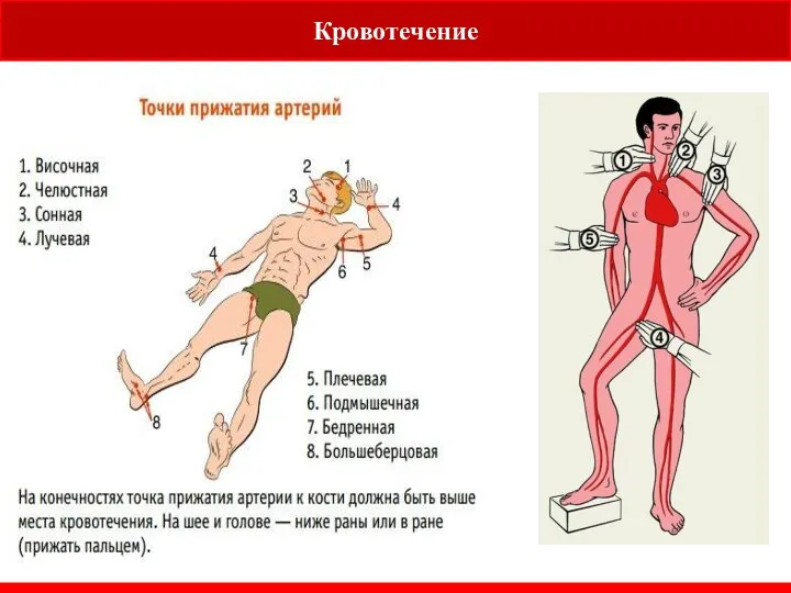 Кровотечение