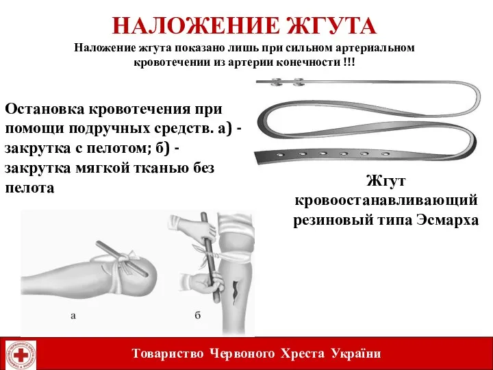 НАЛОЖЕНИЕ ЖГУТА Наложение жгута показано лишь при сильном артериальном кровотечении из