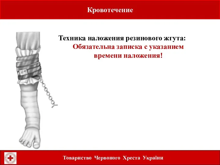 Кровотечение Техника наложения резинового жгута: Обязательна записка с указанием времени наложения! Товариство Червоного Хреста України