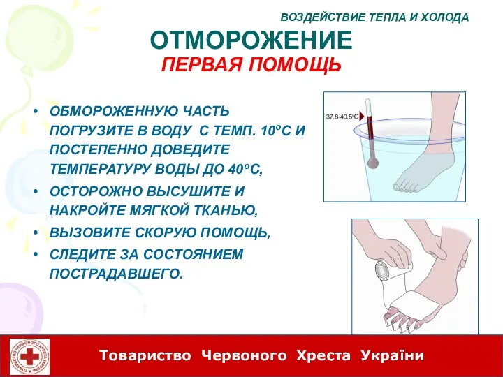 ОТМОРОЖЕНИЕ ПЕРВАЯ ПОМОЩЬ ОБМОРОЖЕННУЮ ЧАСТЬ ПОГРУЗИТЕ В ВОДУ С ТЕМП. 10оC