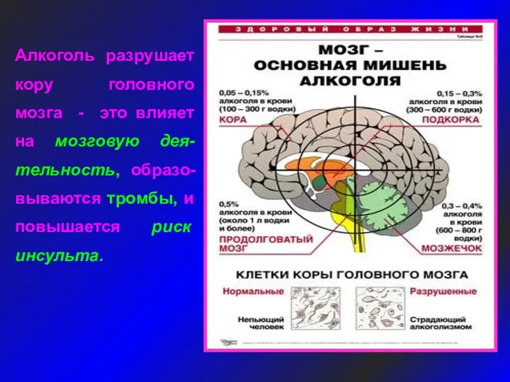 Алкоголь разрушает кору головного мозга - это влияет на мозговую дея-тельность,