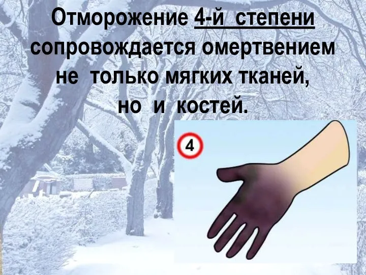 Отморожение 4-й степени сопровождается омертвением не только мягких тканей, но и костей.