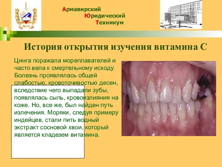 История открытия изучения витамина С Цинга поражала мореплавателей и часто вела