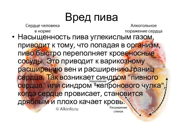 Вред пива Насыщенность пива углекислым газом, приводит к тому, что попадая