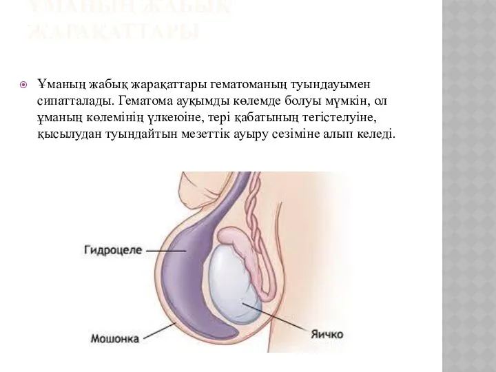 ҰМАНЫҢ ЖАБЫҚ ЖАРАҚАТТАРЫ Ұманың жабық жарақаттары гематоманың туындауымен сипатталады. Гематома ауқымды