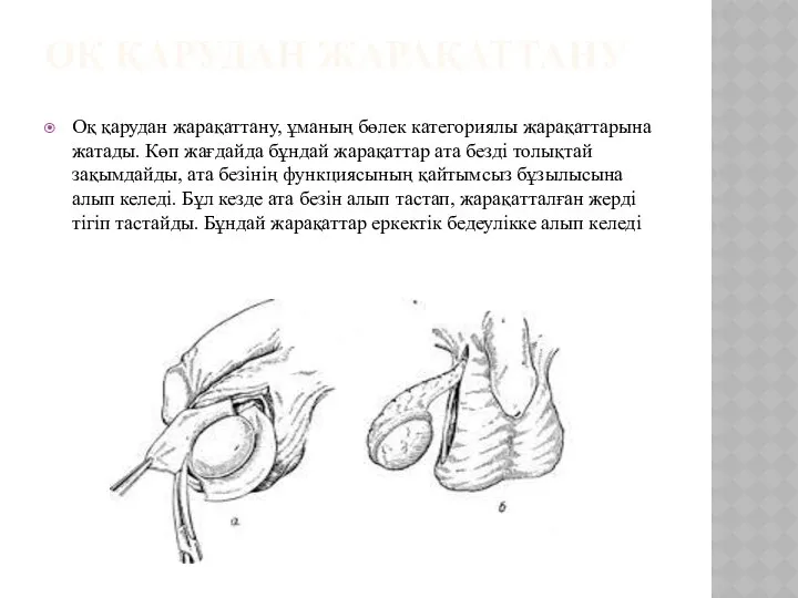 ОҚ ҚАРУДАН ЖАРАҚАТТАНУ Оқ қарудан жарақаттану, ұманың бөлек категориялы жарақаттарына жатады.