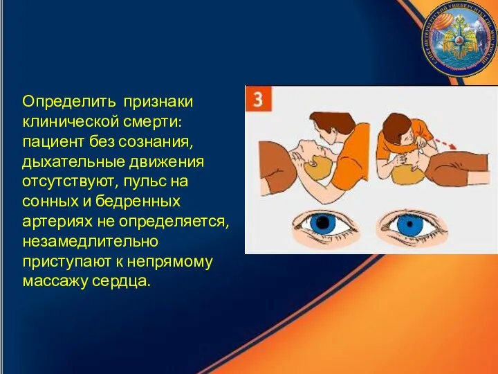 Определить признаки клинической смерти: пациент без сознания, дыхательные движения отсутствуют, пульс