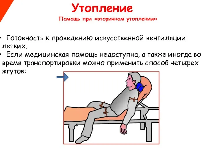 Утопление Готовность к проведению искусственной вентиляции легких. Если медицинская помощь недоступна,